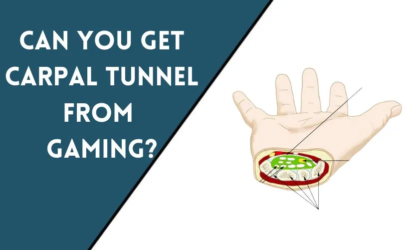 Can You Get Carpal Tunnel from Gaming?